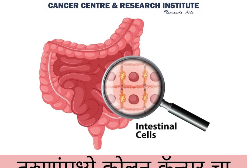 Colon Cancer treatment in Pune