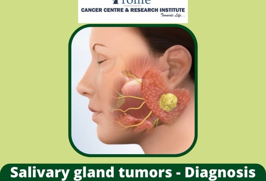 Salivary gland tumors Treatment in Pune