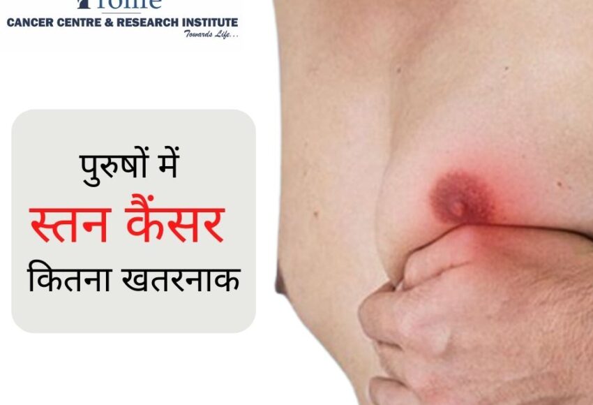 Breast Cancer In Men | Prolife Cancer Centre