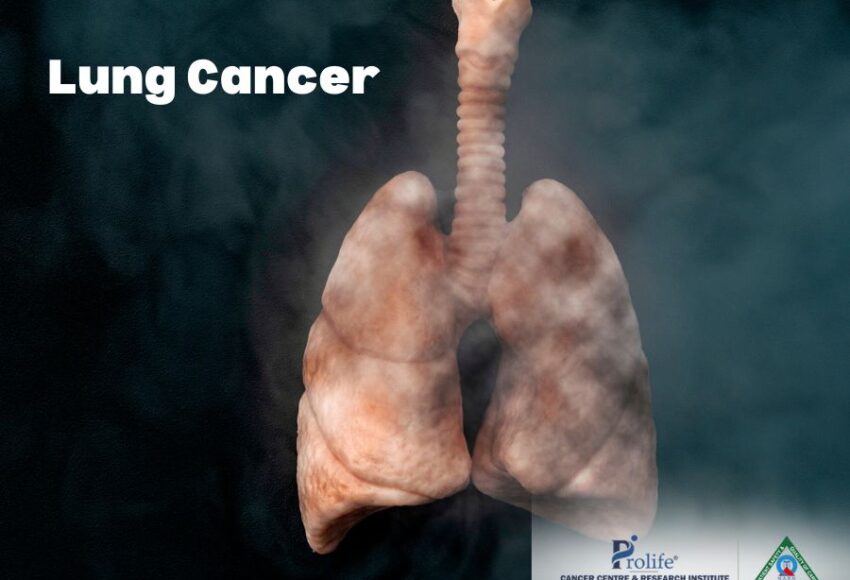 Lung Cancer Symptoms and Causes | Dr. Sumit Shah
