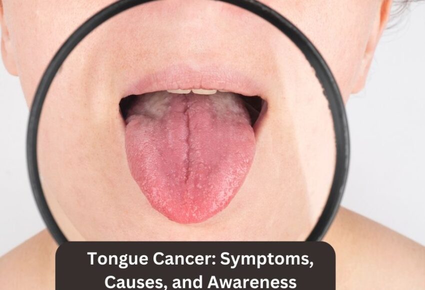 Tongue Cancer: Symptoms, Causes, and Awareness | Dr. Sumit Shah
