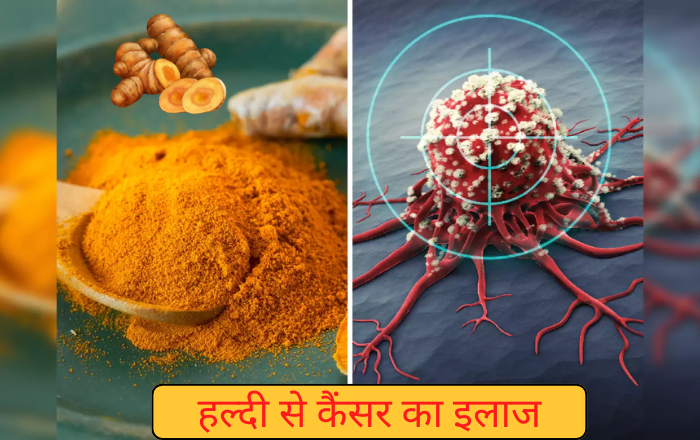 हल्दी से कैंसर का इलाज, क्या मुमकीन है? - Is It Possible To Cure Cancer With Turmeric?