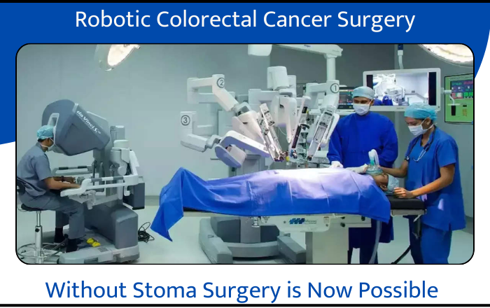 Robotic Colorectal Cancer Surgery: A Revolutionary Approach