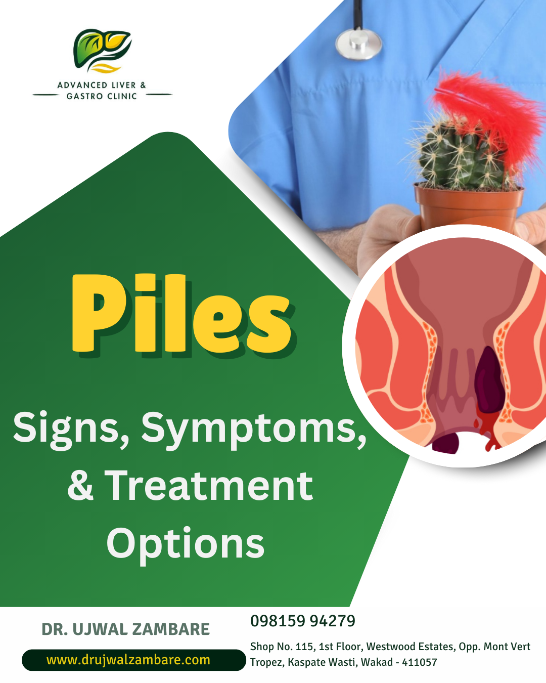 piles specialist in wakad