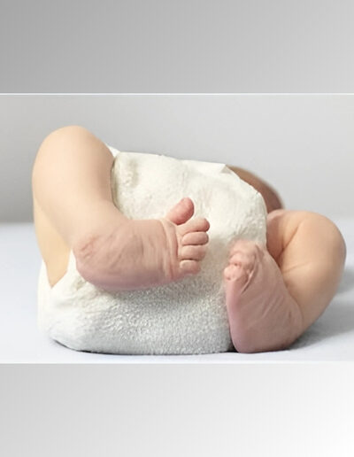 birth-defect-and-congenital-anomalies-service-gallery-1-400x516 (1)