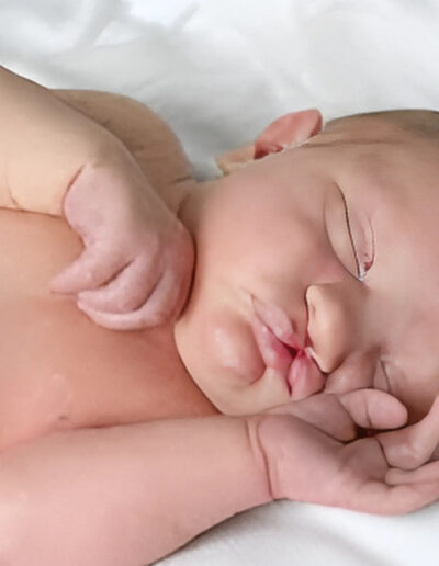 birth-defect-and-congenital-anomalies-service-gallery-2-400x516