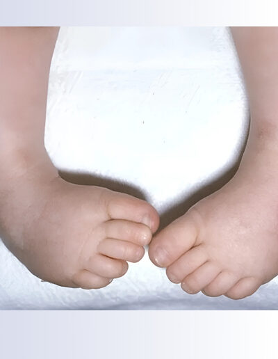 birth-defect-and-congenital-anomalies-service-gallery-3-400x516