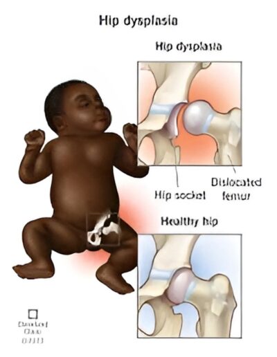 ddh-treatment-banner-gallery-2-400x516