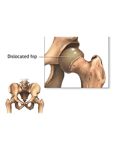ddh-treatment-banner-gallery-3-400x516