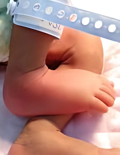 joints-and-bones-infection-gallery-400x516 (1)