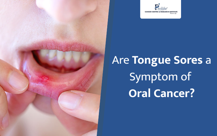 Are Tongue Sores a Symptom of Oral Cancer? What You Need to Know