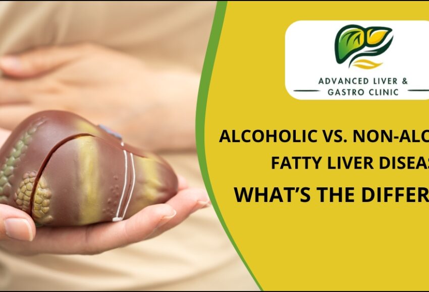 Alcoholic vs Non Alcoholic Liver Disease