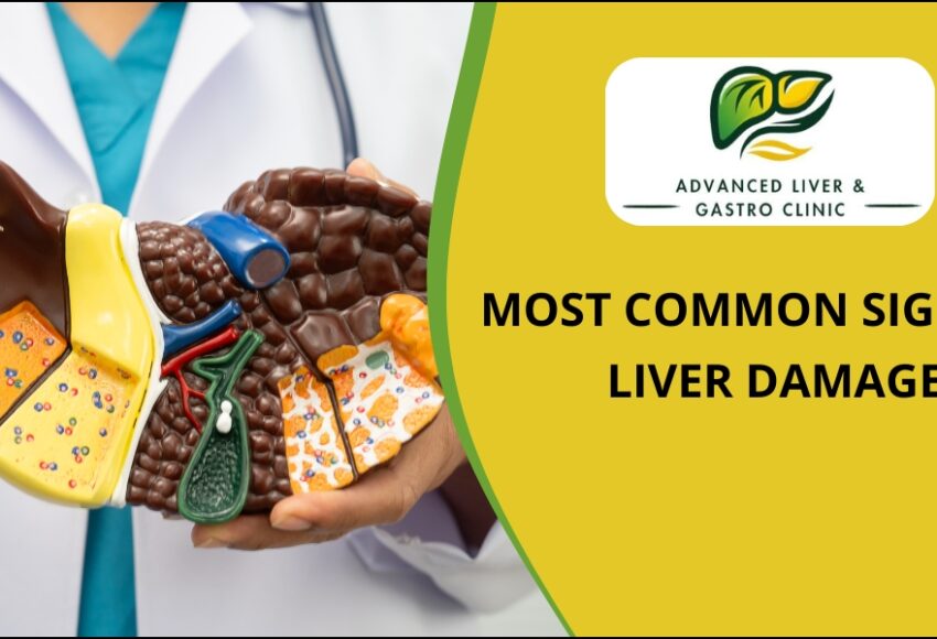 Signs of liver damage