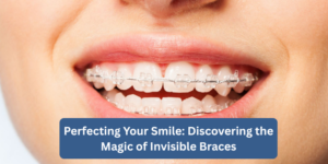 Perfecting Your Smile: Discovering the Magic of Invisible Braces