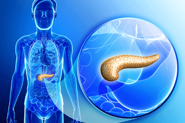 Acute-Pancreatitis-1