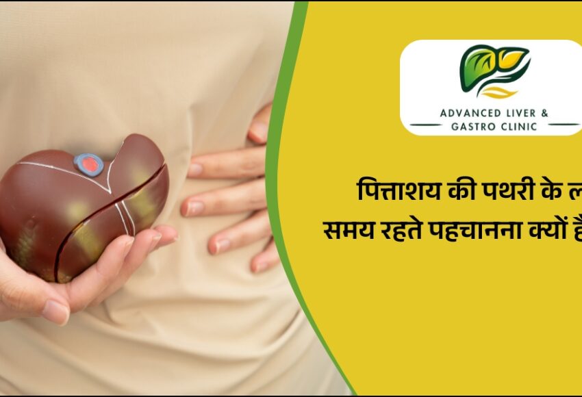 पित्ताशय की पथरी के लक्षण