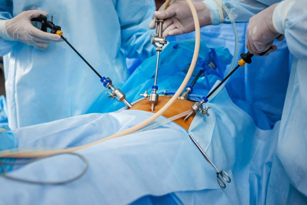 Laparoscopic-Hernia-Surgery-2