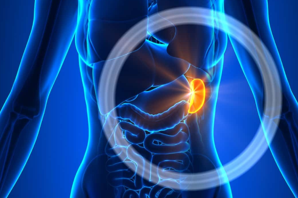 Laparoscopic-Splenectomy