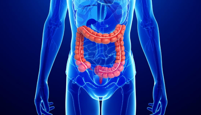 crohns-disease