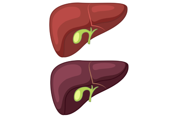 healthy-cirrhosis