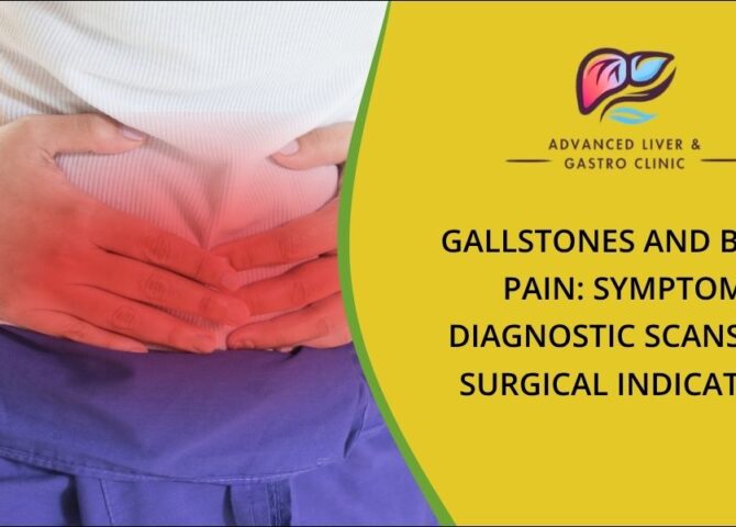 Gallstone and biliary pain symptoms