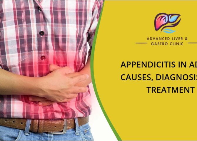 Appendicitis treatment in Wakad