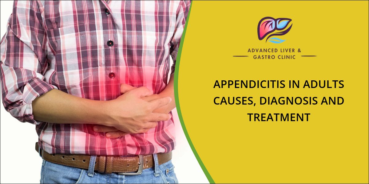Appendicitis treatment in Wakad